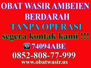 Illustration for article titled Obat Alternatif Wasir Ambeien Yang Paling Manjur